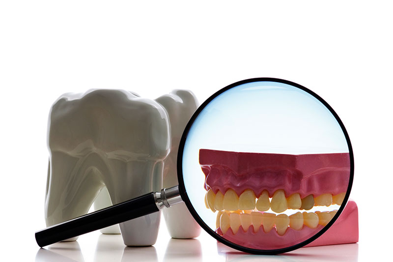 Root Canal in Panama City