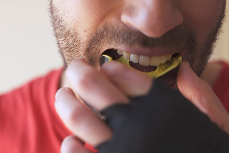 Mouthguards in Panama City