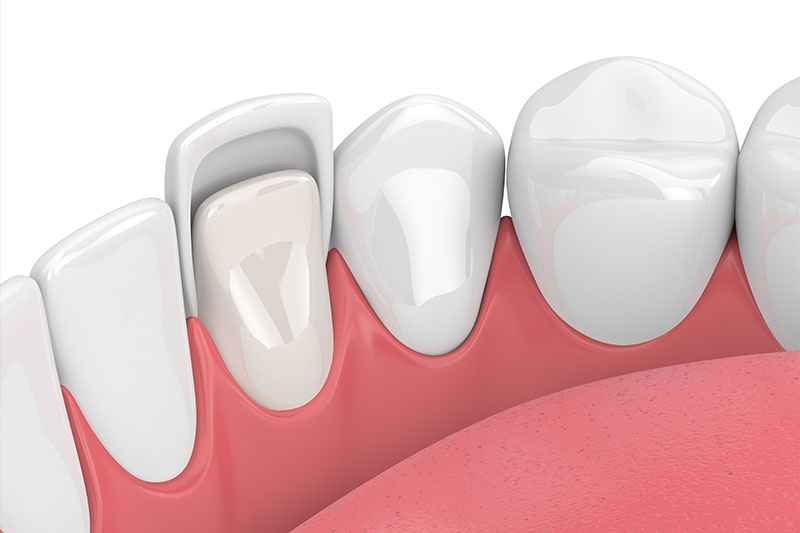 Cosmetic Dentistry in Panama City